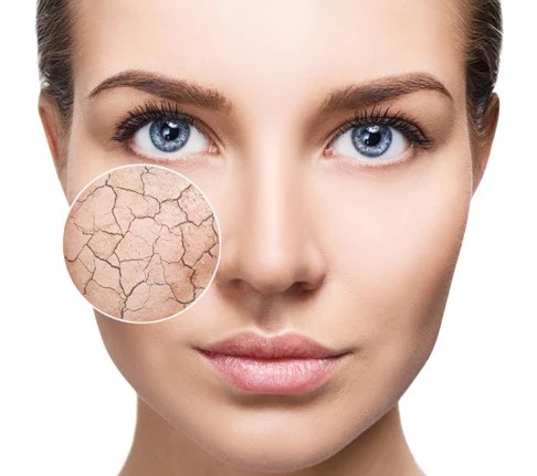 Face Cream for Dry Skin - Image 2
